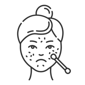 Acne Scar Treatment